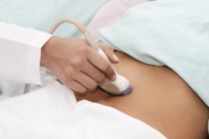 Диспепсия желудка: симптомы, причины, методы диагностики и лечения